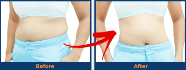 Consti-Slim Before and After